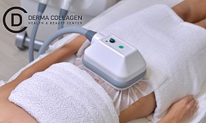 Derma Collagen (Πατησίων), Πατησίων